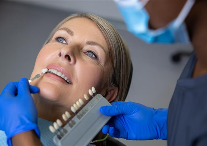 EMAX Veneers